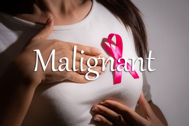 《经济学人》每日一词：malignant