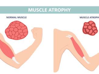 《经济学人》每日一词：atrophy